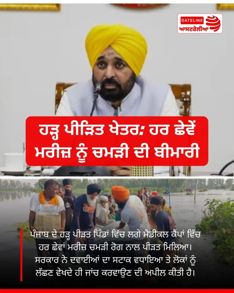 ਹੜ੍ਹ ਪੀੜਤ ਚਮੜੀ ਰੋਗ