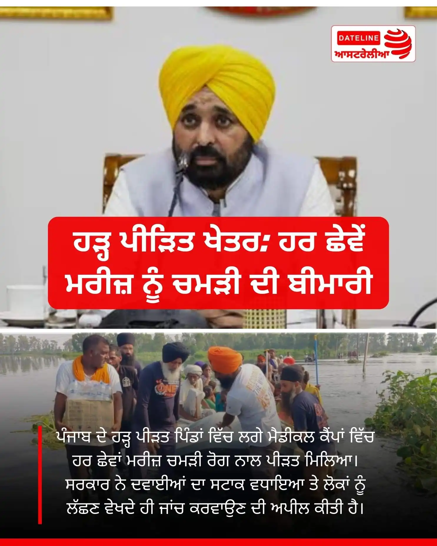 ਹੜ੍ਹ ਪੀੜਤ ਚਮੜੀ ਰੋਗ